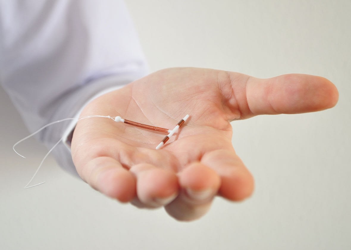 IUCD Insertion/Removal